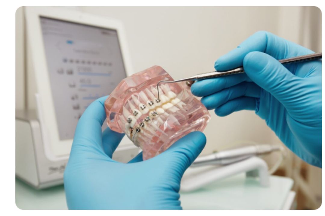 Affordable braces in Mumbai